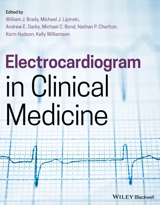 Cover image for Electrocardiogram in Clinical Medicine